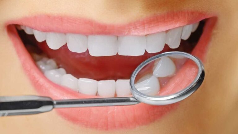 Harmonização do Sorriso: Tudo o que você precisa saber